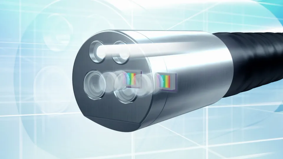 Illustration: 2026 Laparoscopy Advancements: Robotics, AI, and Enhanced Safety