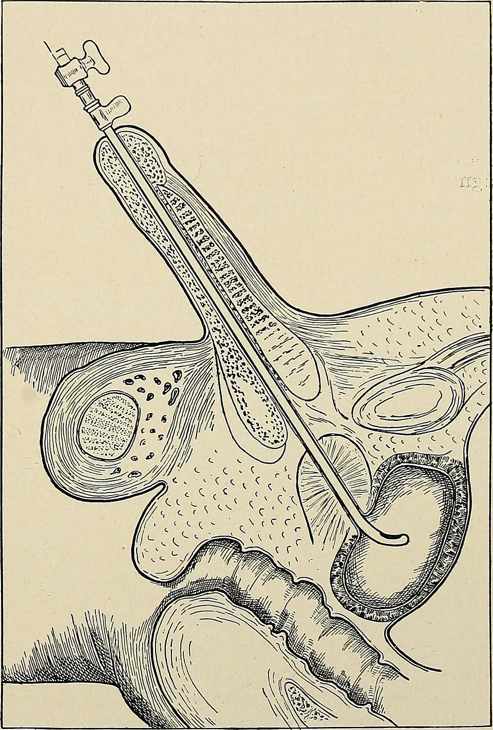 Illustration: Frequently Asked Questions About Diet After Surgery