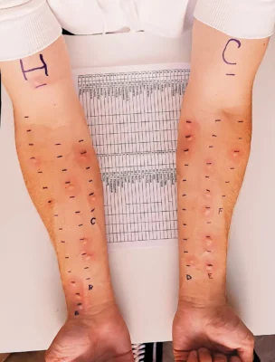 Illustration: Local Sioux City Resources and When to Consult an Allergy Specialist