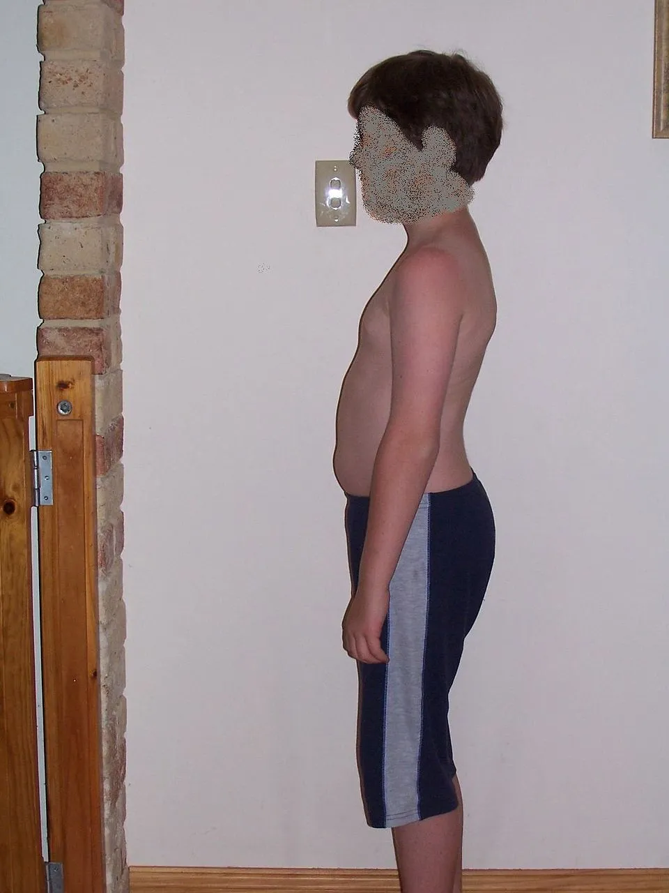 Illustration: Medical Weight Loss Options: Surgery and the Team Approach at Midlands Clinic