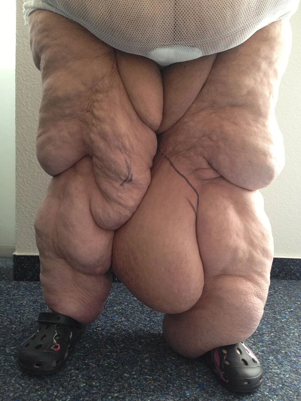 Illustration: Weight Loss Results, Recovery, and Long-Term Success