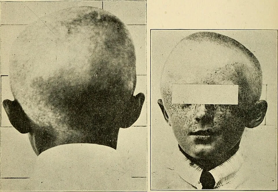 Illustration: What Foods Should You Avoid After Surgery?
